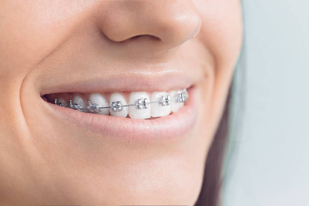 Best Veneers and Lumineers  in Beverly, MA